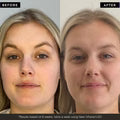 PHOTON LED light therapy face mask