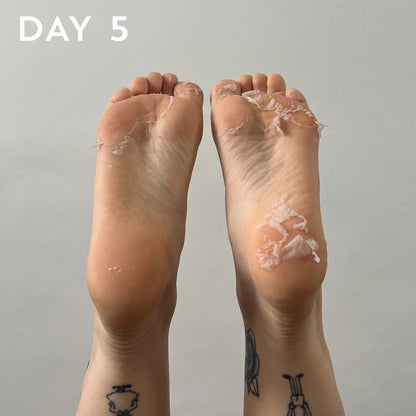 FOOT PEEL Professional Foot Treatment